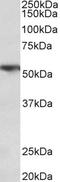 Surfactant Protein A1 antibody, 42-993, ProSci, Enzyme Linked Immunosorbent Assay image 