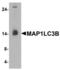 Microtubule Associated Protein 1 Light Chain 3 Beta antibody, LS-B10153, Lifespan Biosciences, Western Blot image 