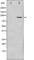 Inhibitor Of Nuclear Factor Kappa B Kinase Subunit Beta antibody, abx010973, Abbexa, Western Blot image 