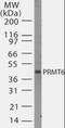 Protein Arginine Methyltransferase 6 antibody, orb86510, Biorbyt, Western Blot image 