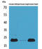 Adrenomedullin antibody, STJ96567, St John