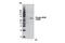 BLNK antibody, 3601S, Cell Signaling Technology, Western Blot image 