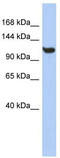 Transmembrane Protein 63C antibody, TA338418, Origene, Western Blot image 