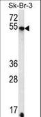 Syndecan-3 antibody, LS-C168909, Lifespan Biosciences, Western Blot image 