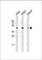 Perilipin-3 antibody, M02977, Boster Biological Technology, Western Blot image 