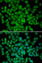 Cyclin Dependent Kinase Inhibitor 2C antibody, 18-463, ProSci, Immunofluorescence image 