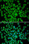 Cyclin Dependent Kinase Inhibitor 2C antibody, 18-463, ProSci, Immunofluorescence image 
