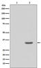 Cyclin Dependent Kinase 2 antibody, MP00166, Boster Biological Technology, Western Blot image 