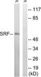 Serum Response Factor antibody, LS-B11340, Lifespan Biosciences, Western Blot image 