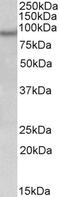 Aldehyde Dehydrogenase 6 Family Member A1 antibody, 42-679, ProSci, Western Blot image 