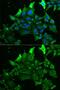 G protein-coupled receptor kinase 6 antibody, GTX54160, GeneTex, Immunocytochemistry image 