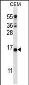 Transmembrane Protein 254 antibody, PA5-71711, Invitrogen Antibodies, Western Blot image 