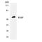 URI1 Prefoldin Like Chaperone antibody, LS-C200606, Lifespan Biosciences, Western Blot image 