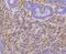 TNF Receptor Superfamily Member 12A antibody, A06261-2, Boster Biological Technology, Immunohistochemistry frozen image 