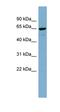 NOP58 Ribonucleoprotein antibody, orb326124, Biorbyt, Western Blot image 