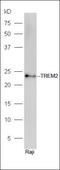 Triggering Receptor Expressed On Myeloid Cells 2 antibody, orb313249, Biorbyt, Western Blot image 