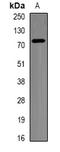 Beta-Transducin Repeat Containing E3 Ubiquitin Protein Ligase antibody, LS-B14579, Lifespan Biosciences, Western Blot image 