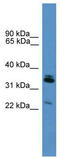 Synaptoporin antibody, TA342623, Origene, Western Blot image 