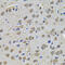 Transglutaminase 1 antibody, 22-878, ProSci, Immunohistochemistry frozen image 
