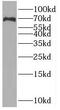 Solute Carrier Family 6 Member 8 antibody, FNab07973, FineTest, Western Blot image 