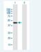 Arsenite Methyltransferase antibody, H00057412-B01P-50ug, Novus Biologicals, Western Blot image 