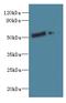 Family With Sequence Similarity 124 Member B antibody, A59014-100, Epigentek, Western Blot image 