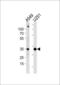Ankyrin Repeat And SOCS Box Containing 9 antibody, PA5-35281, Invitrogen Antibodies, Western Blot image 