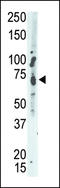 Protein Tyrosine Phosphatase Non-Receptor Type 9 antibody, LS-C100980, Lifespan Biosciences, Western Blot image 
