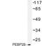 Core-Binding Factor Subunit Beta antibody, LS-C176931, Lifespan Biosciences, Western Blot image 