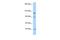 Oral-facial-digital syndrome 1 protein antibody, A02955, Boster Biological Technology, Western Blot image 