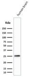 Ubiquitin C-Terminal Hydrolase L1 antibody, GTX34970, GeneTex, Western Blot image 