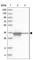 Aldose reductase antibody, HPA026425, Atlas Antibodies, Western Blot image 