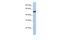 Solute Carrier Family 38 Member 9 antibody, PA5-69930, Invitrogen Antibodies, Western Blot image 