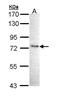 Inhibitor Of Nuclear Factor Kappa B Kinase Subunit Epsilon antibody, NBP1-33052, Novus Biologicals, Western Blot image 
