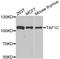 TATA-Box Binding Protein Associated Factor, RNA Polymerase I Subunit C antibody, A6759, ABclonal Technology, Western Blot image 