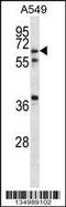 Glucagon Like Peptide 2 Receptor antibody, 58-043, ProSci, Western Blot image 