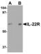 Interleukin 22 Receptor Subunit Alpha 1 antibody, 40107, QED Bioscience, Western Blot image 