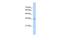 Ras Suppressor Protein 1 antibody, GTX46246, GeneTex, Western Blot image 