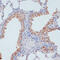 Solute Carrier Family 39 Member 4 antibody, 19-072, ProSci, Immunohistochemistry frozen image 