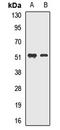 Meis Homeobox 2 antibody, LS-C667848, Lifespan Biosciences, Western Blot image 