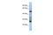 Testis Expressed 47 antibody, PA5-44360, Invitrogen Antibodies, Western Blot image 