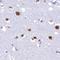 SURP And G-Patch Domain Containing 2 antibody, NBP1-87868, Novus Biologicals, Immunohistochemistry paraffin image 