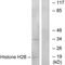 Histone Cluster 1 H2B Family Member H antibody, PA5-49864, Invitrogen Antibodies, Western Blot image 