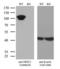 Nuclear Receptor Subfamily 3 Group C Member 1 antibody, LS-C790847, Lifespan Biosciences, Western Blot image 