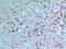 Thymidine Phosphorylase antibody, A06329, Boster Biological Technology, Immunohistochemistry frozen image 