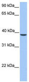Sad1 And UNC84 Domain Containing 3 antibody, TA334963, Origene, Western Blot image 