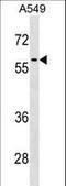 Regulator Of Chromosome Condensation 2 antibody, LS-C158831, Lifespan Biosciences, Western Blot image 