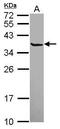 Secretagogin, EF-Hand Calcium Binding Protein antibody, GTX115442, GeneTex, Western Blot image 