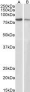 Junction Plakoglobin antibody, LS-B2204, Lifespan Biosciences, Western Blot image 