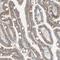 Transmembrane And Immunoglobulin Domain Containing 2 antibody, NBP1-81164, Novus Biologicals, Immunohistochemistry frozen image 